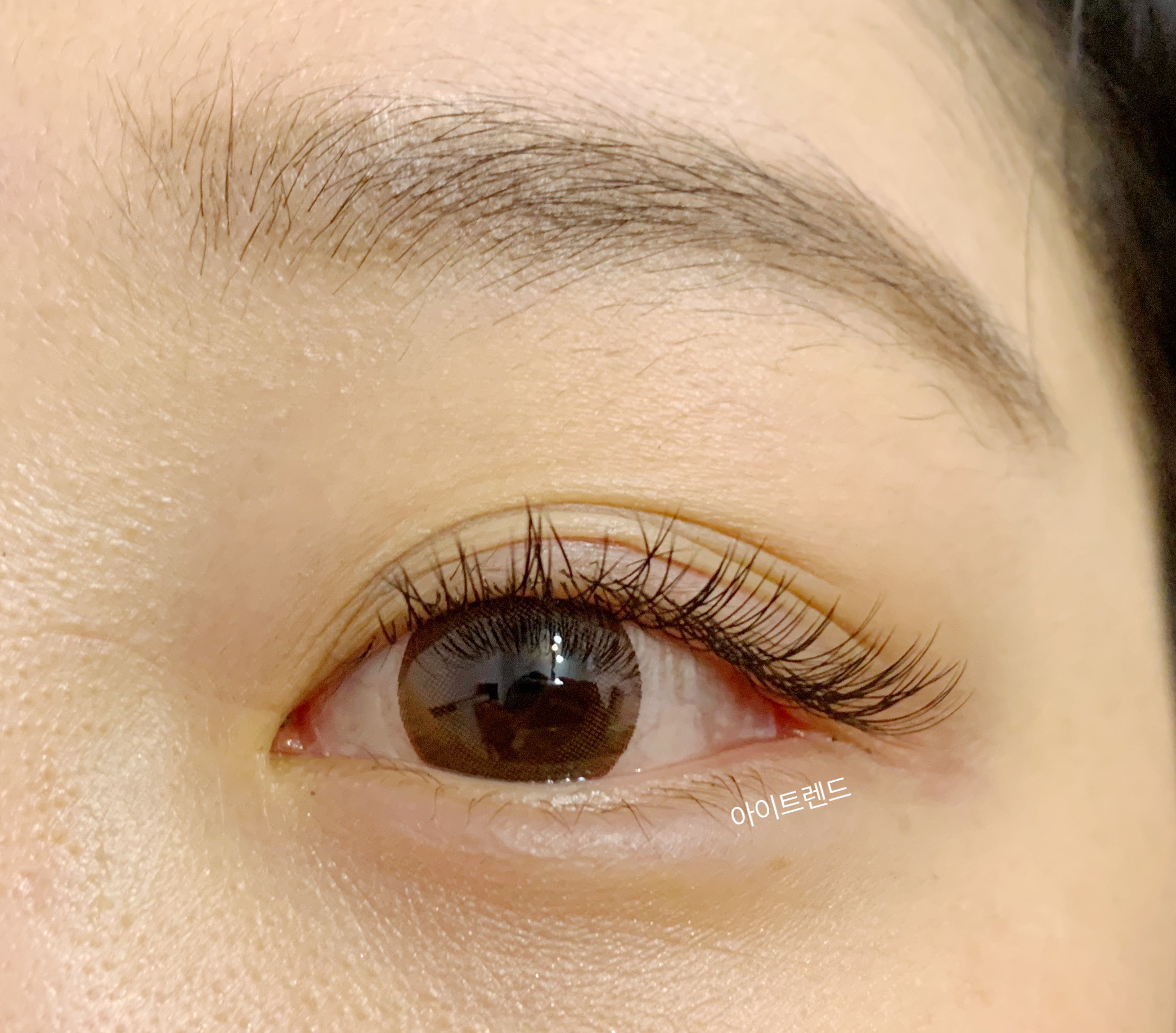 아이트렌드 대표 이미지