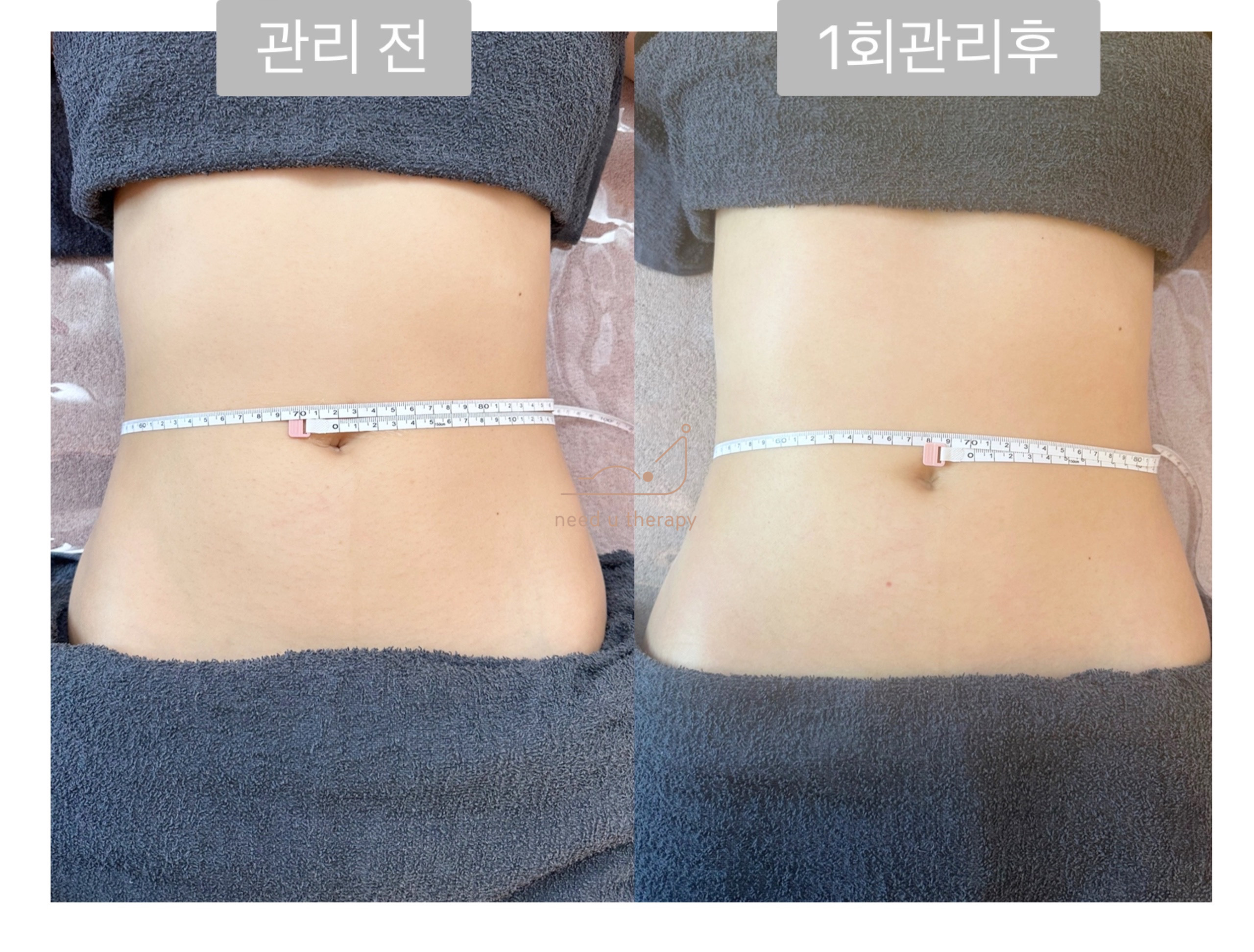 니쥬테라피