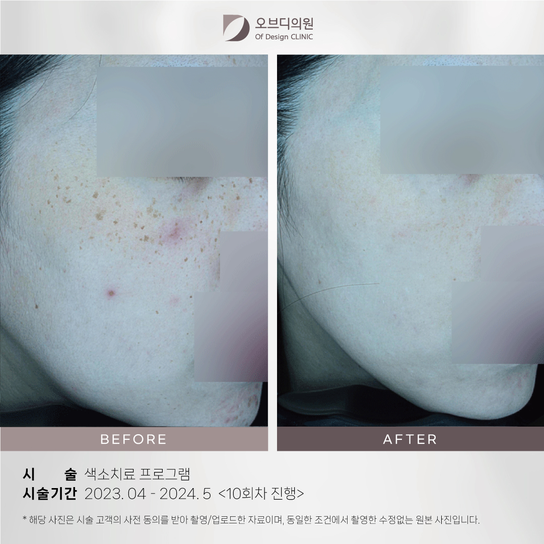 오브디의원
