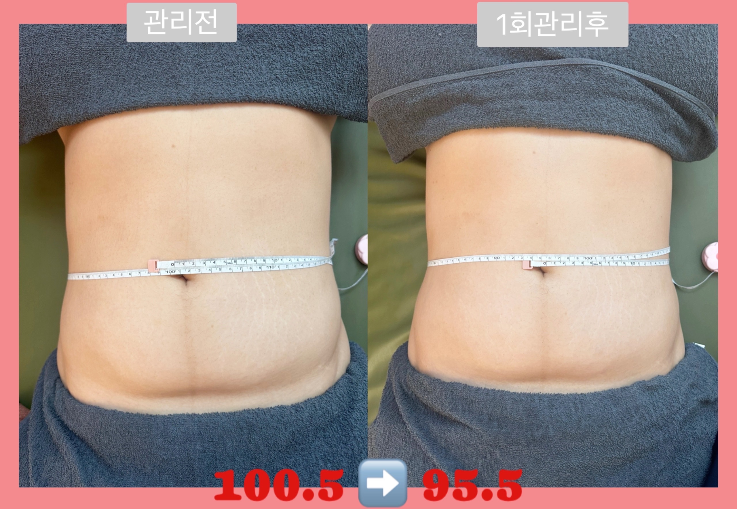 니쥬테라피