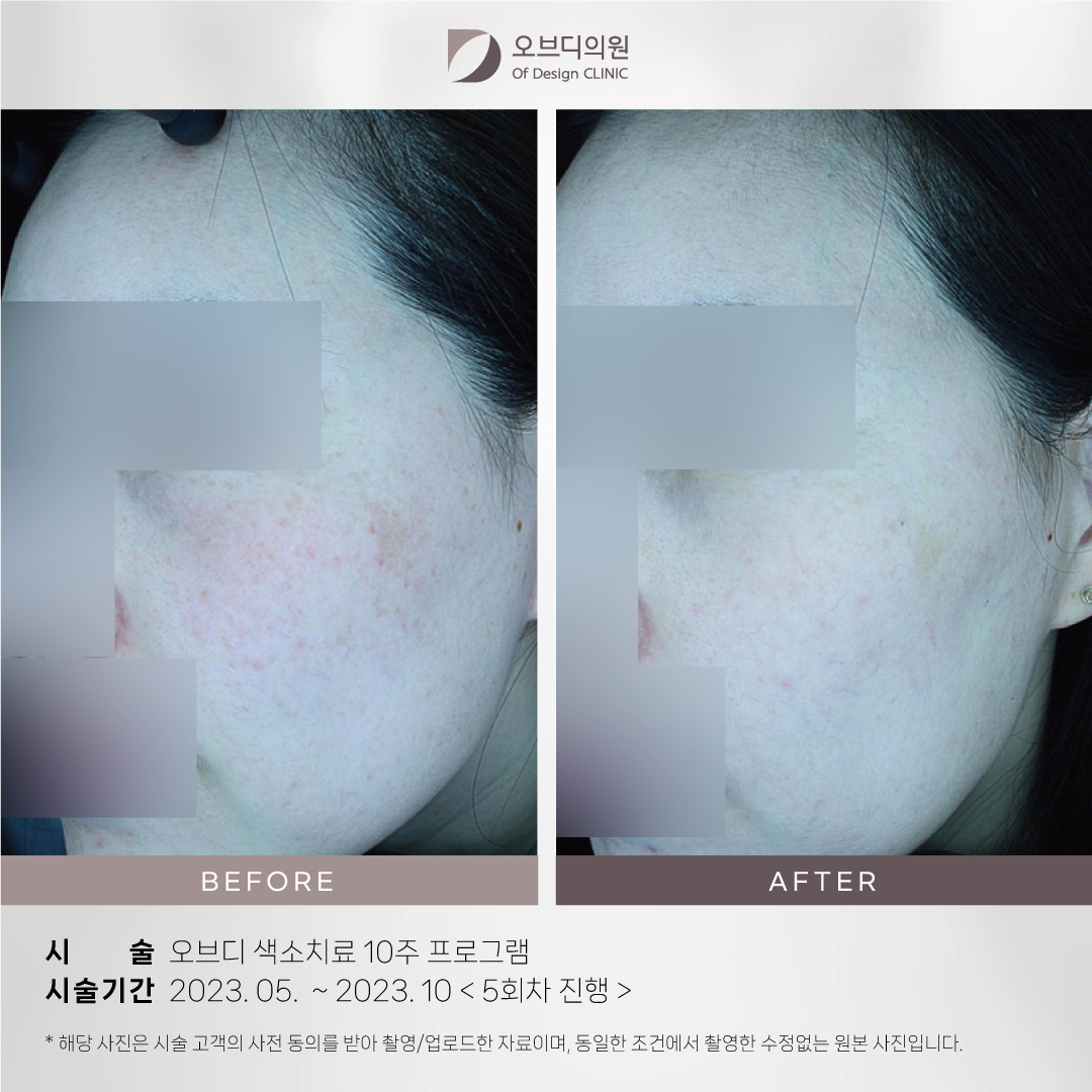 오브디의원 대표 이미지