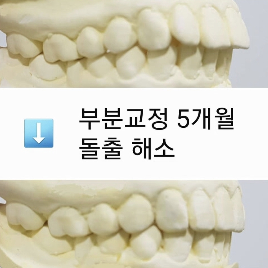 연세윌치과의원 대표 이미지
