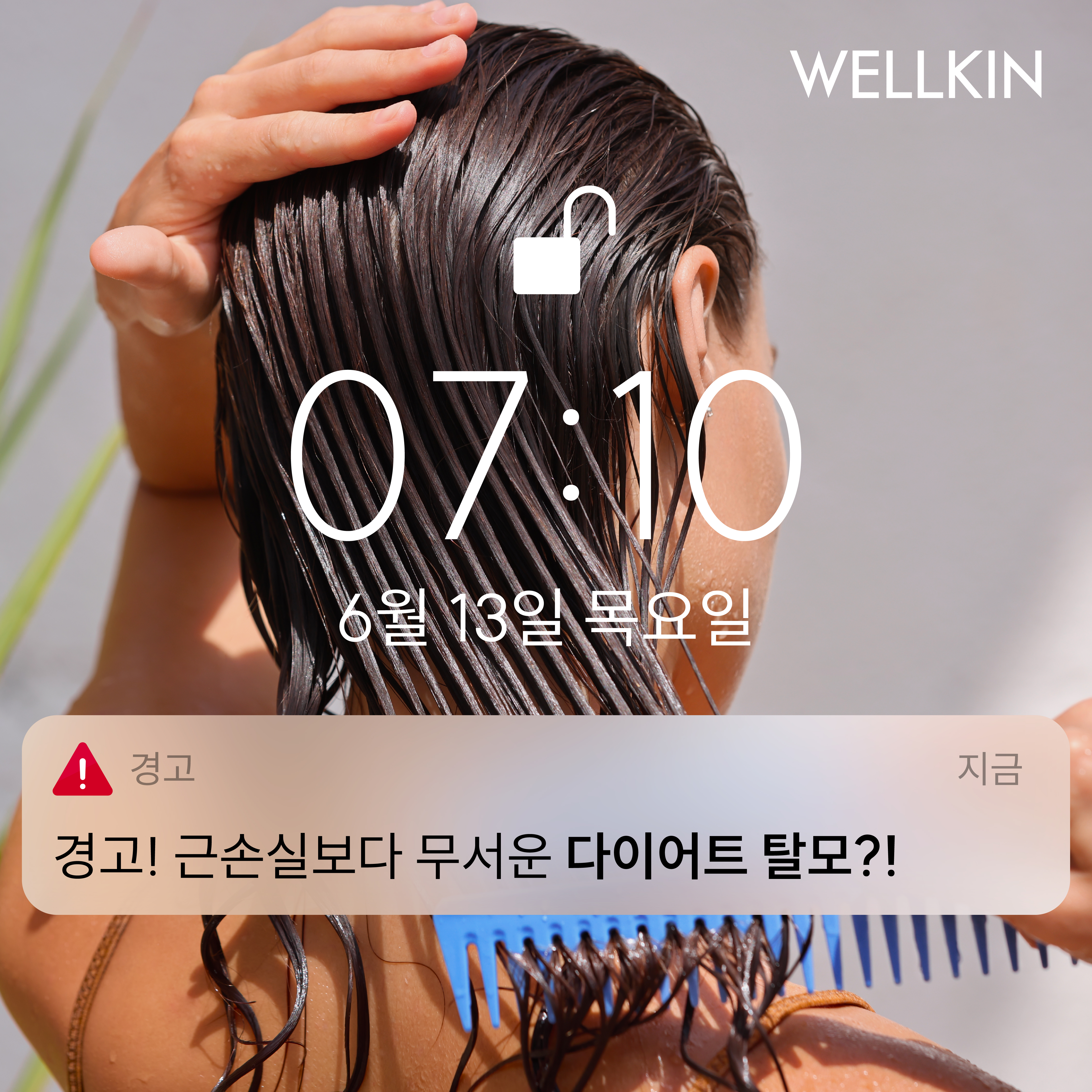 웰킨두피탈모센터 수원인계점