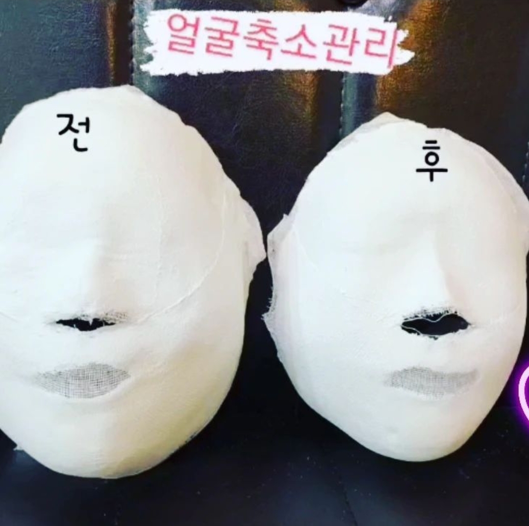 W스킨 대표 이미지