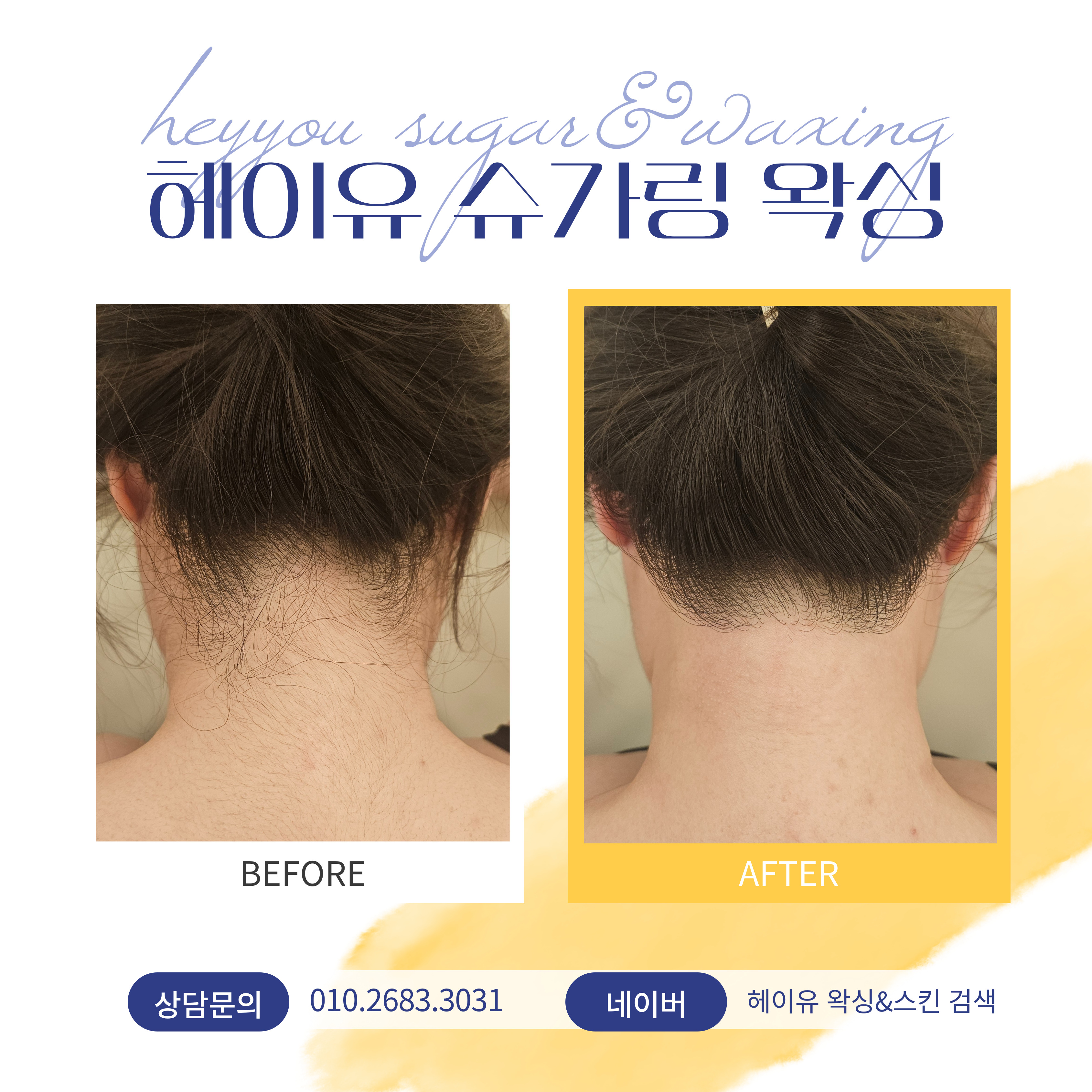 헤이유 왁싱&스킨 인천용현본점