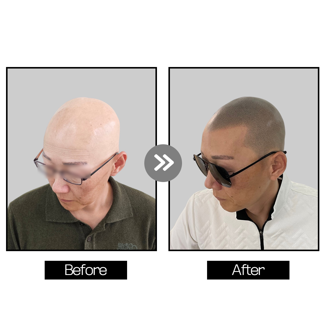 디블랙아카데미