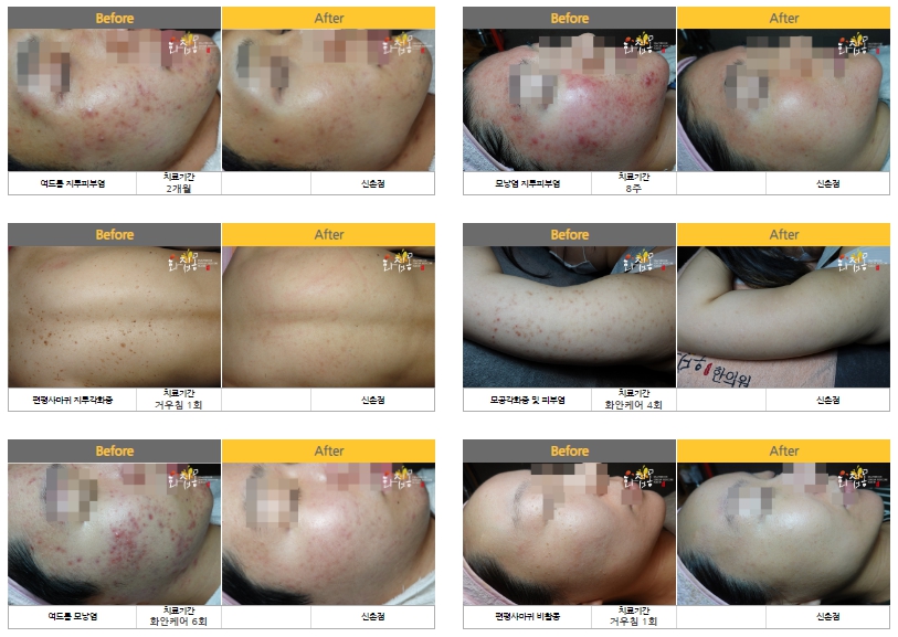 화접몽한의원 신촌 대표 이미지