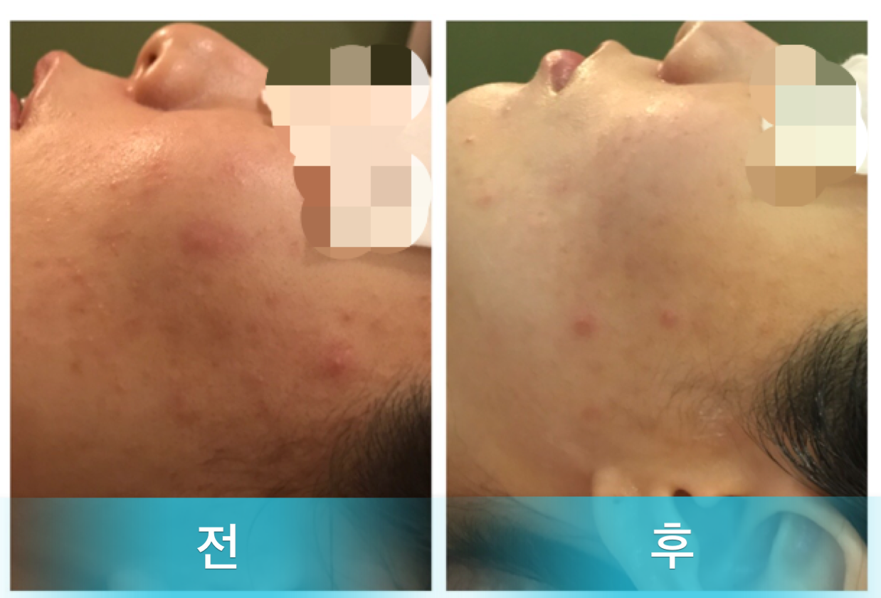 스킨소울