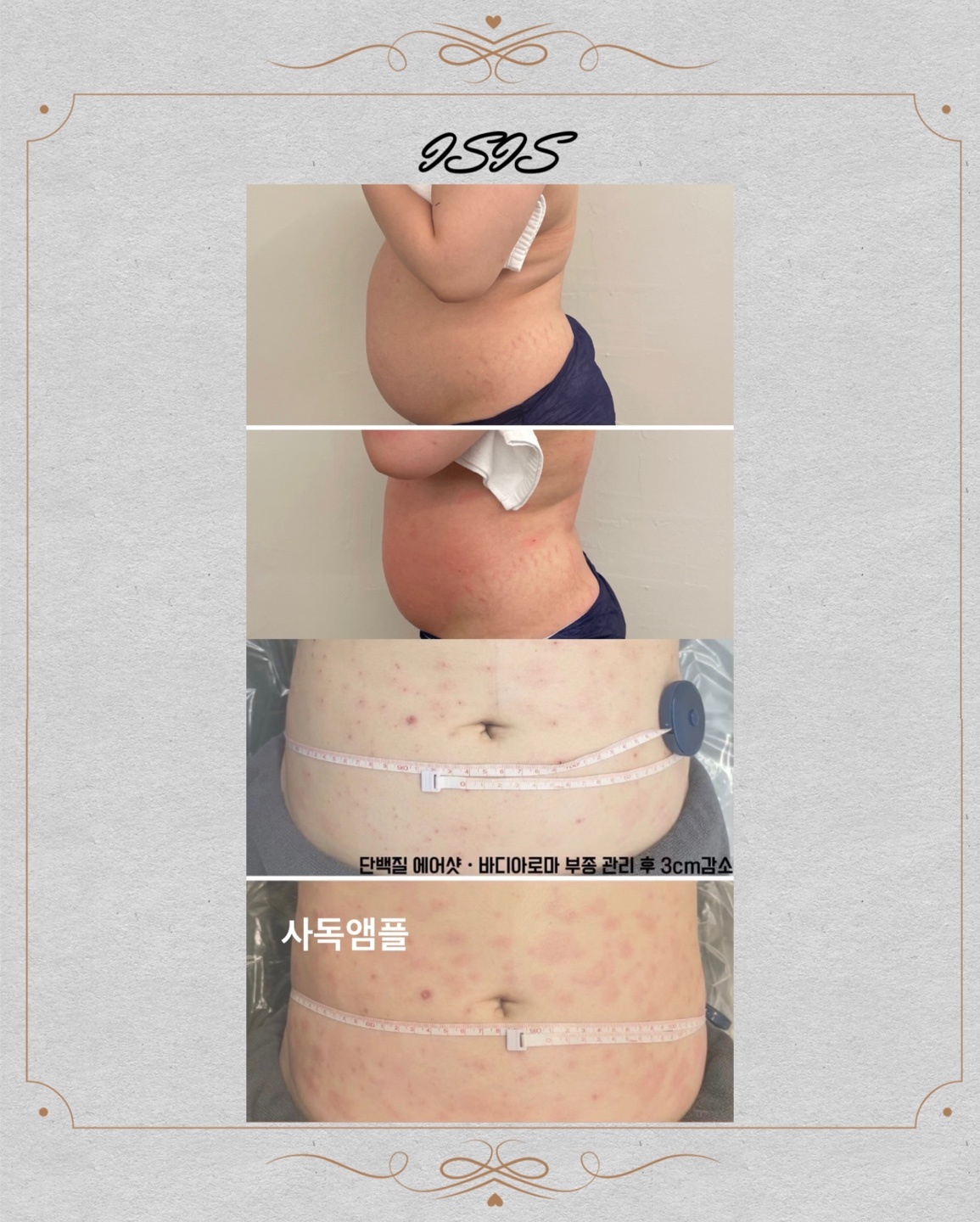 가현스킨&바디
