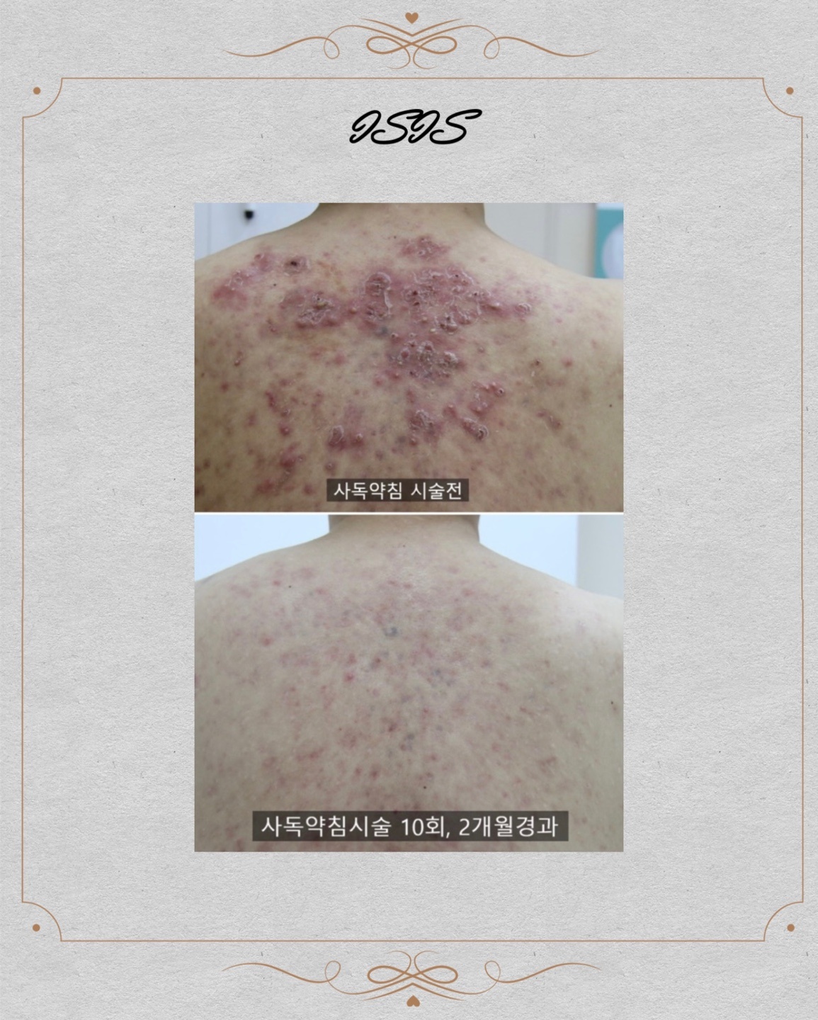 가현스킨&바디