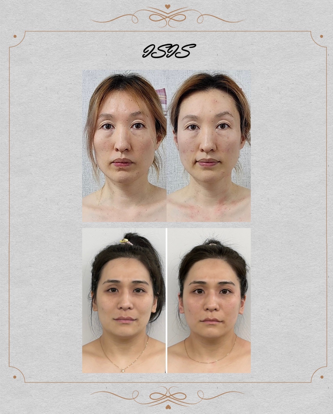 가현스킨&바디