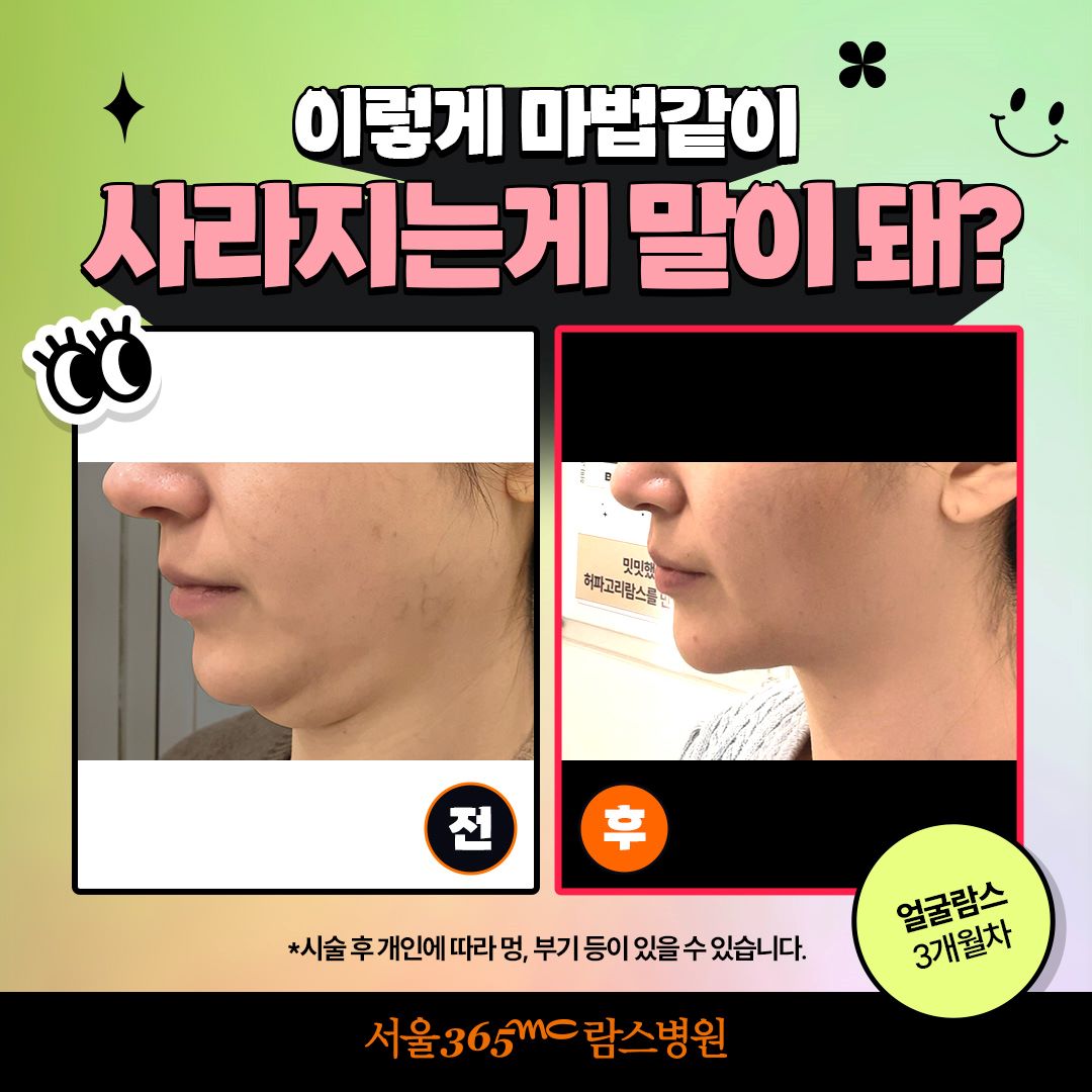 365mc병원