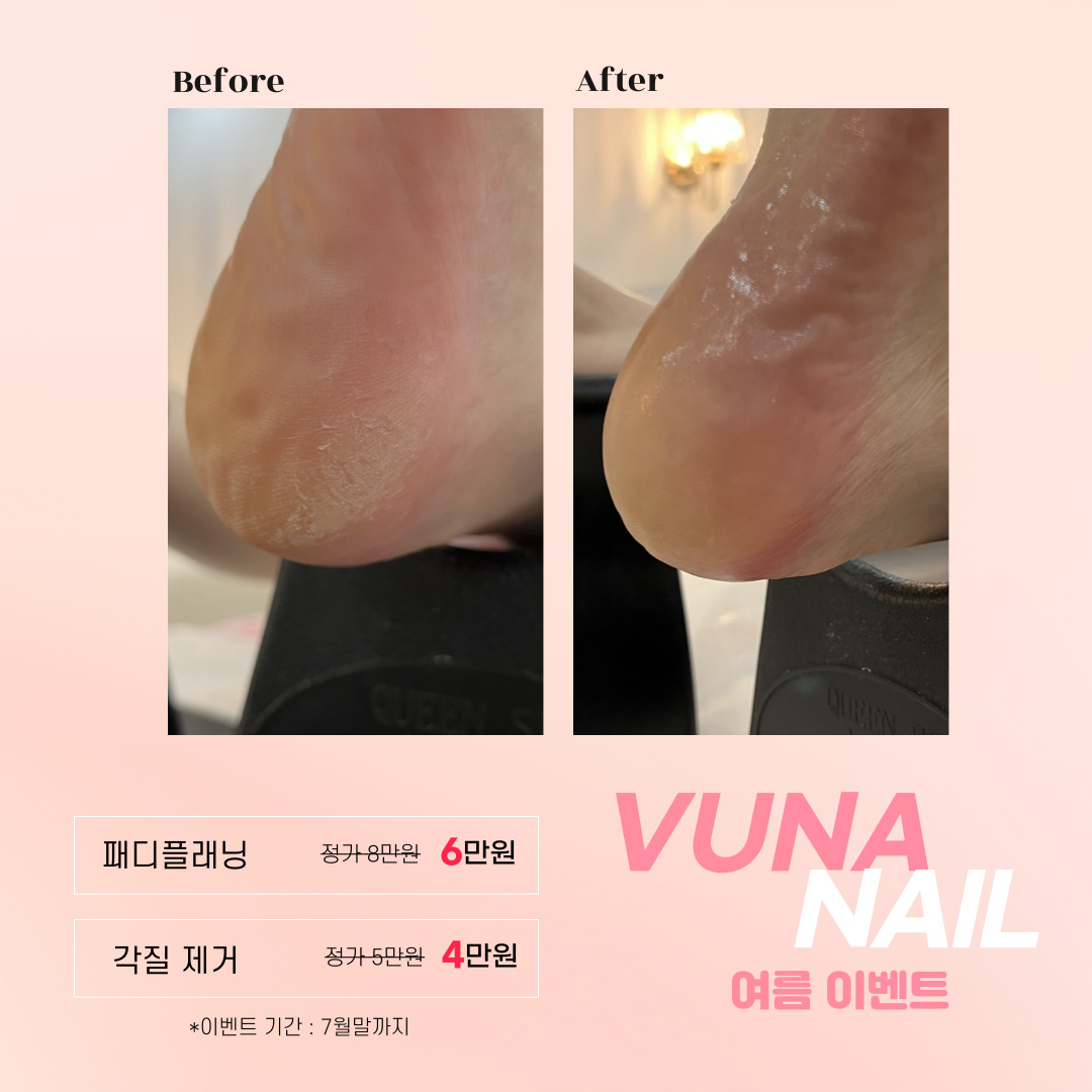 뷰나네일
