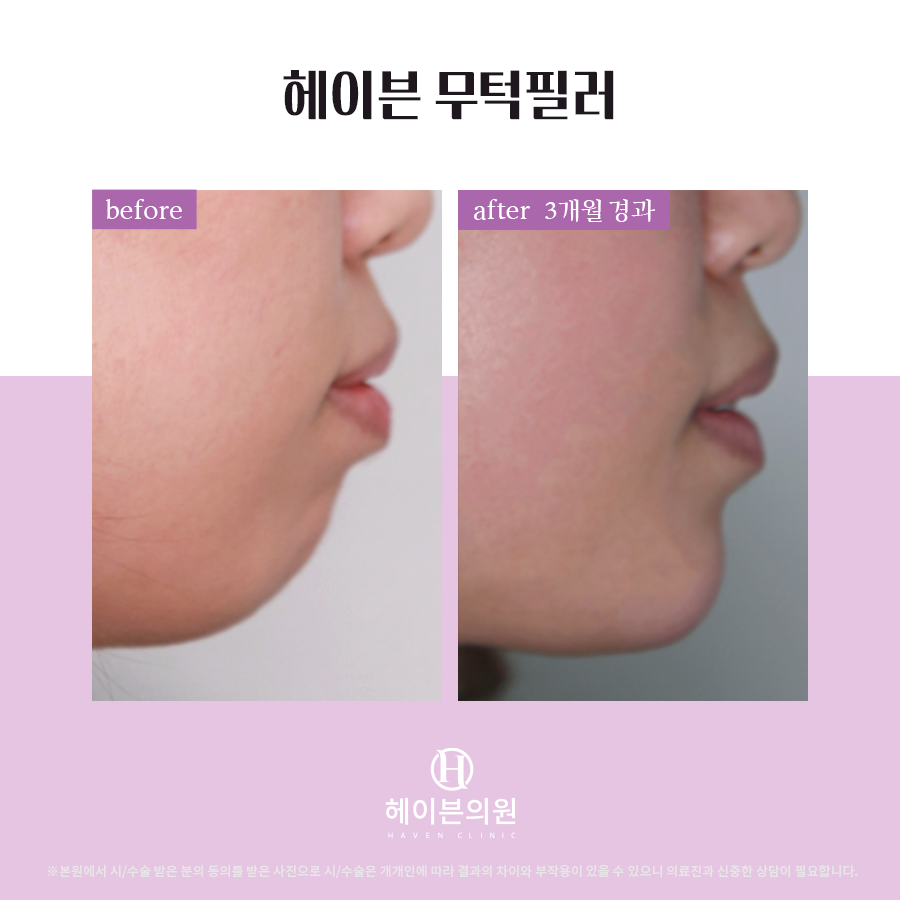 헤이븐의원 대표 이미지