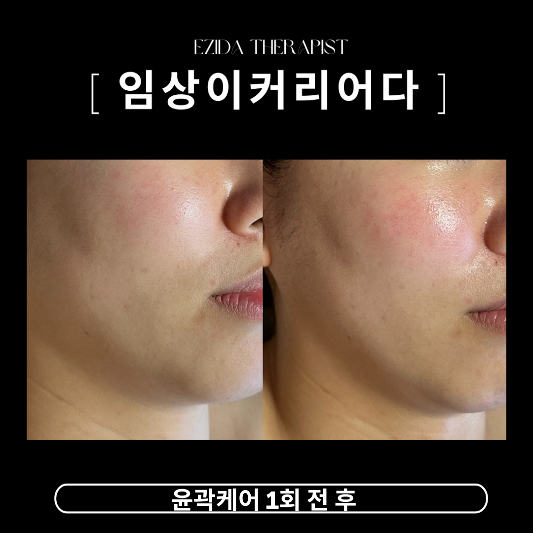 엘라인 이지다 대표 이미지