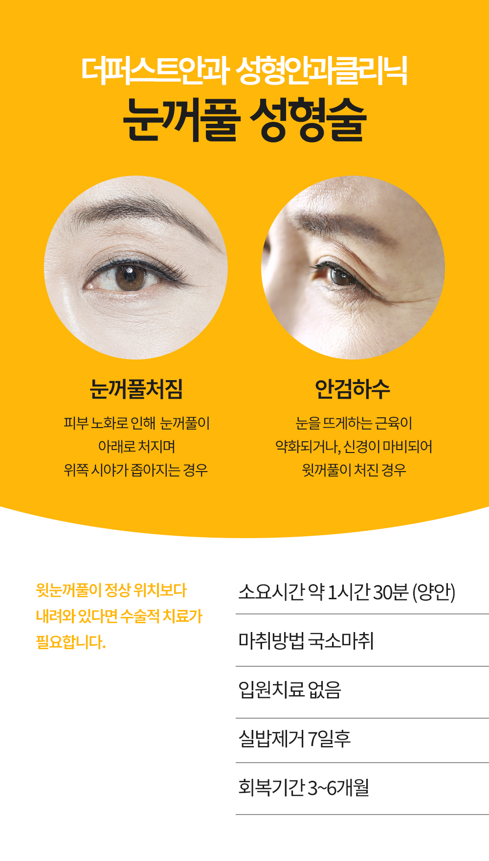 더퍼스트안과의원