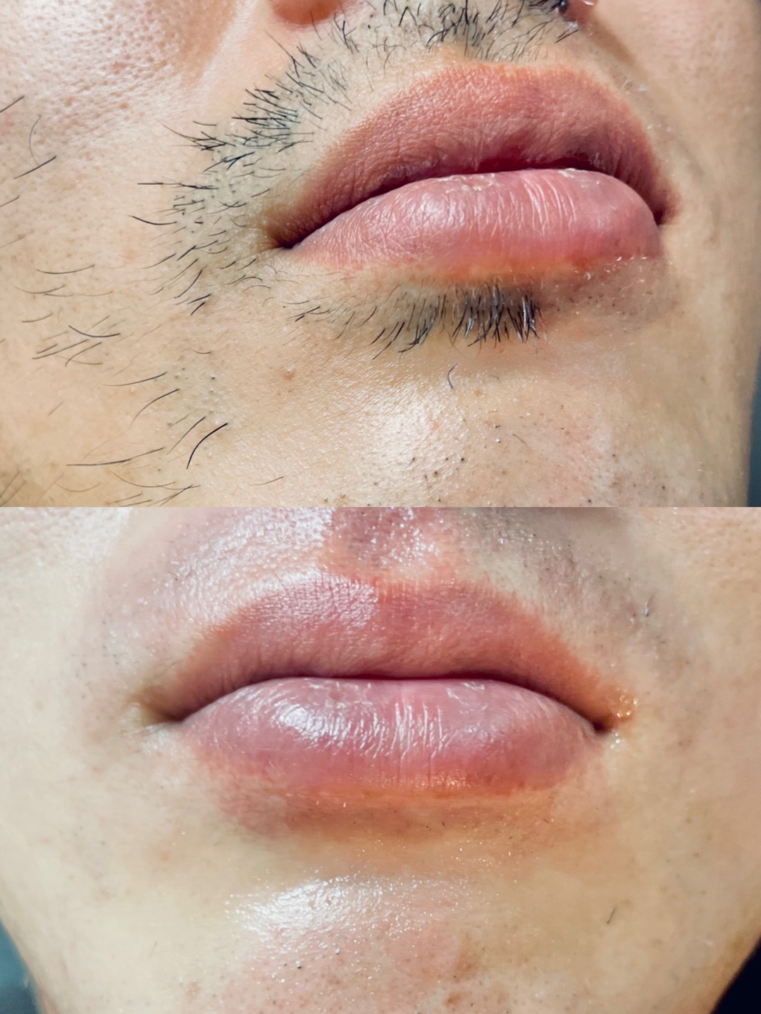 모발퀸 대표 이미지