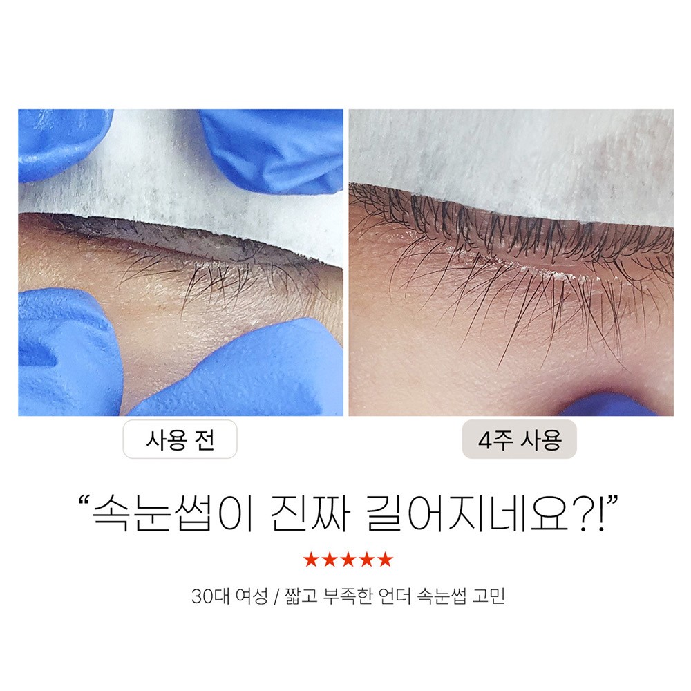 아쎄르뷰티