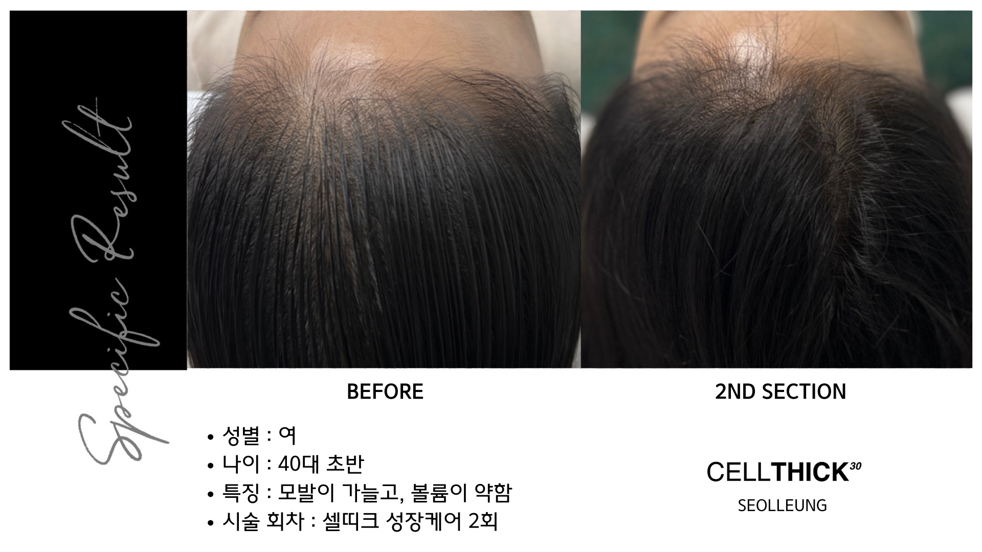 라온하제 두피 탈모케어 눈썹 속눈썹펌 천안본점