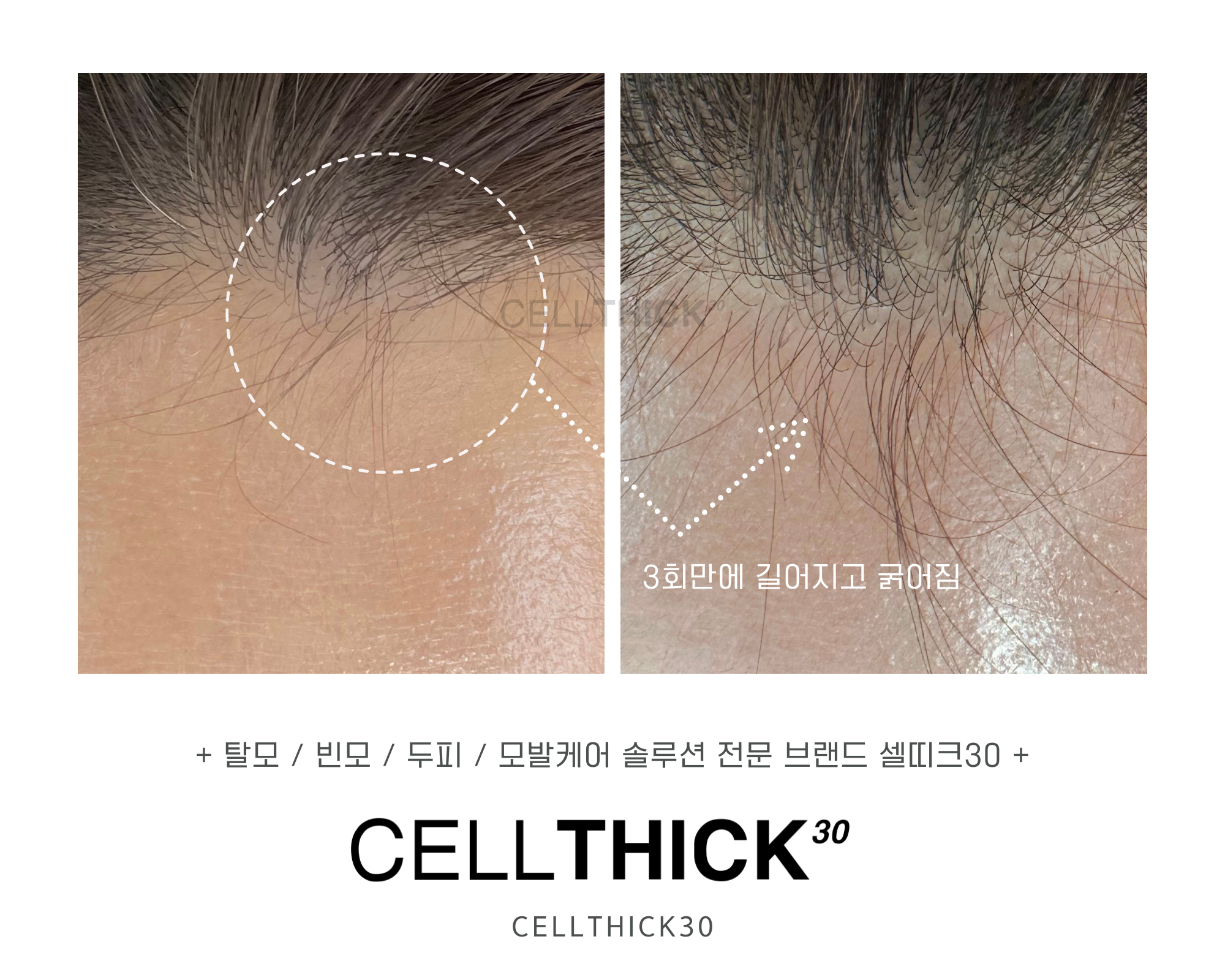 라온하제 두피 탈모케어 눈썹 속눈썹펌 천안본점