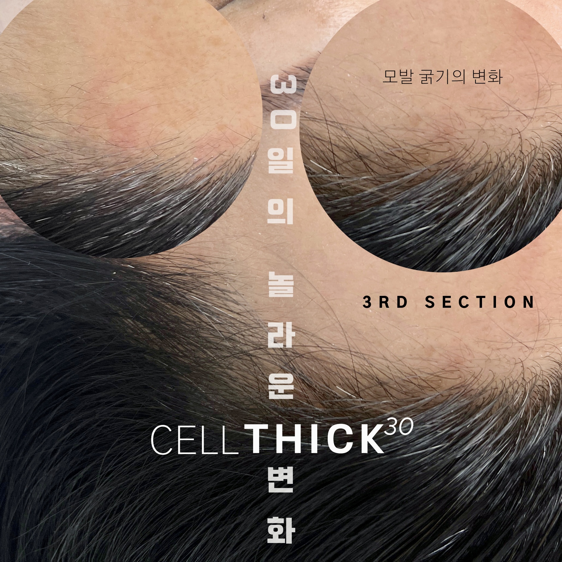 라온하제 두피 탈모케어 눈썹 속눈썹펌 천안본점