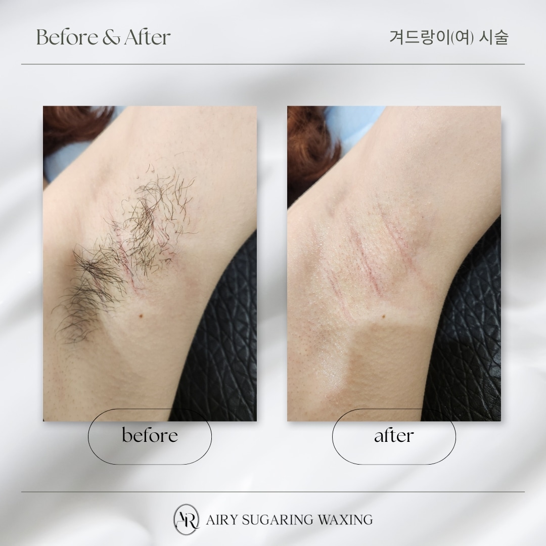 에어리 슈가링왁싱 대표 이미지