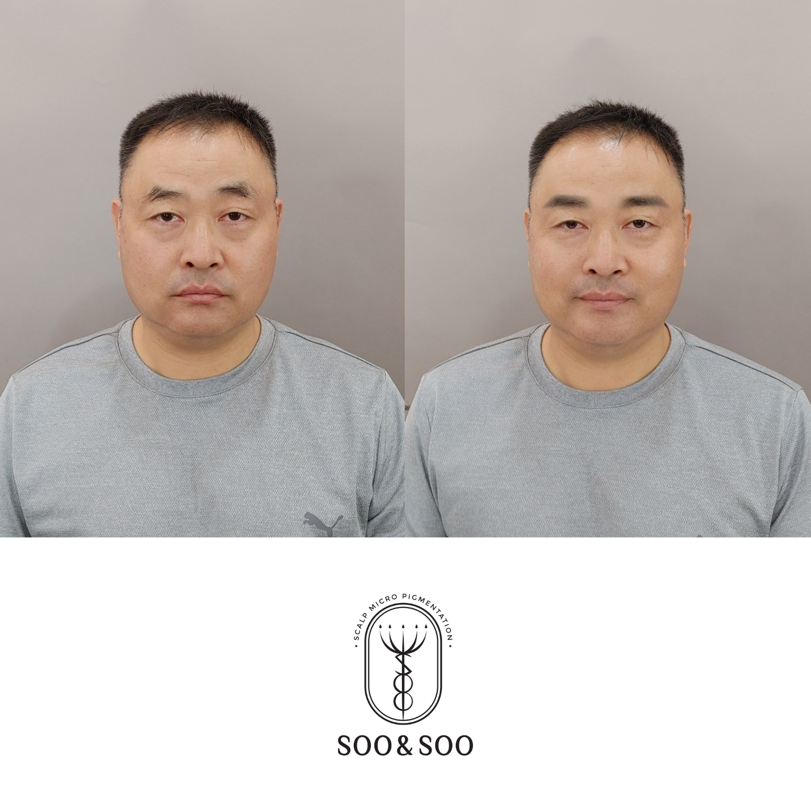 수앤수뷰티