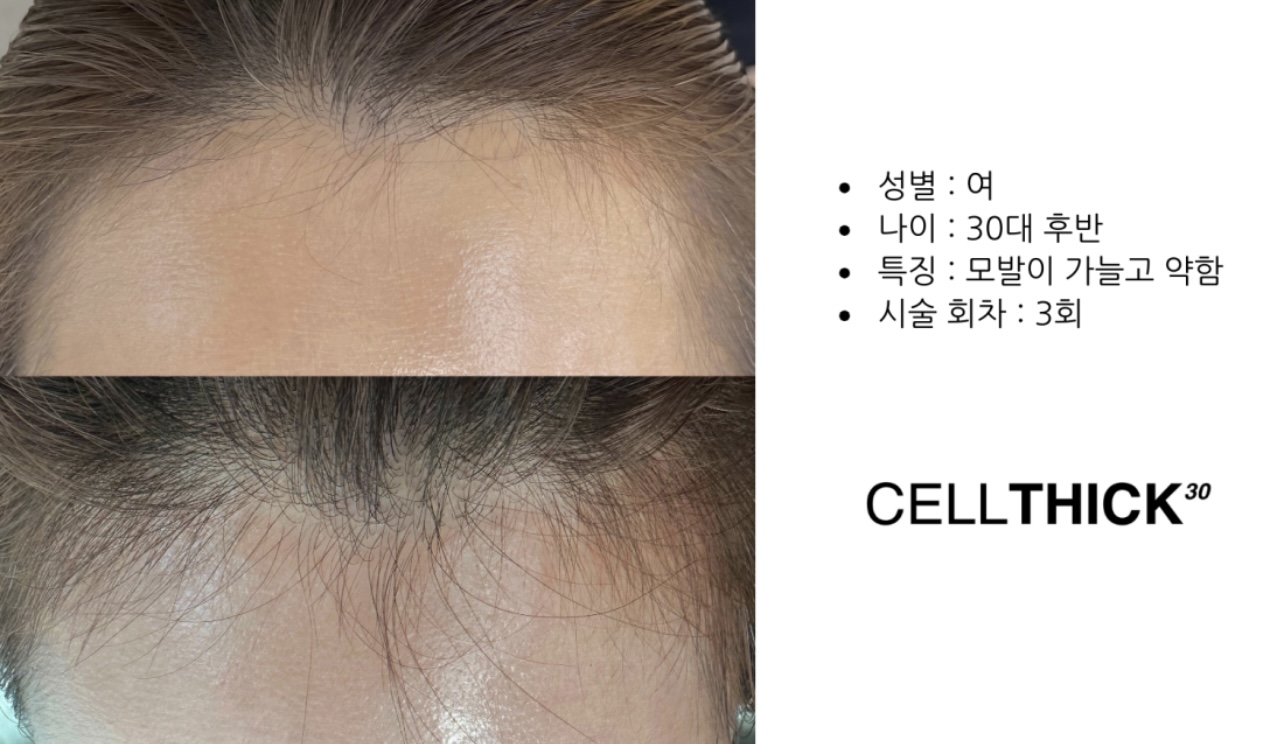 라온하제 두피 탈모케어 눈썹 속눈썹펌 천안본점
