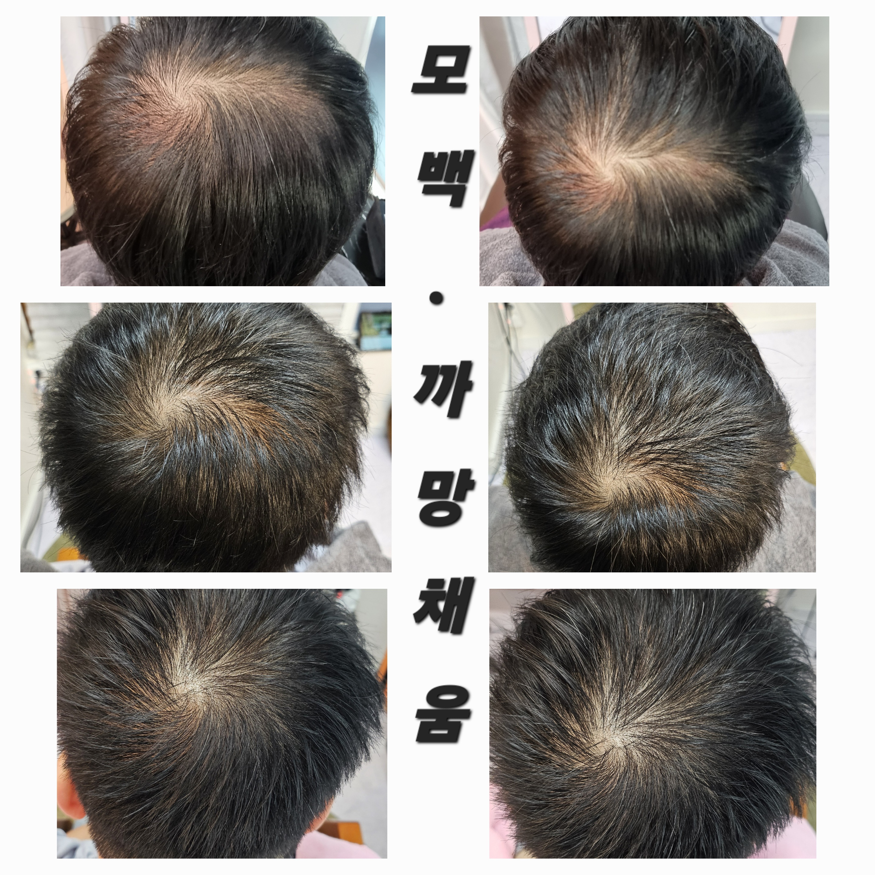 까망채움스칼프