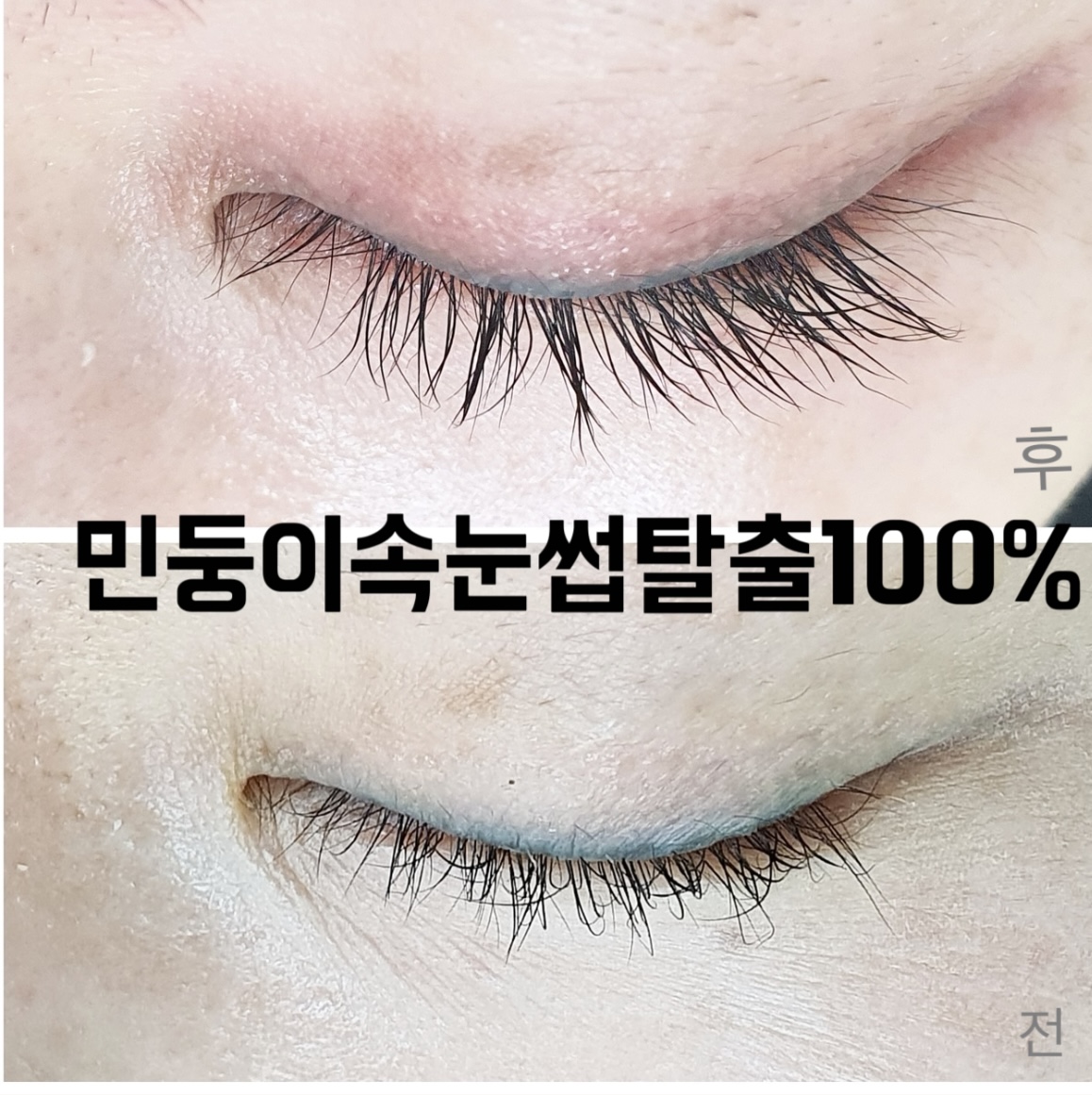 라온하제 두피 탈모케어 눈썹 속눈썹펌 천안본점