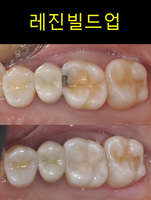 다라플란트치과의원 대표 이미지