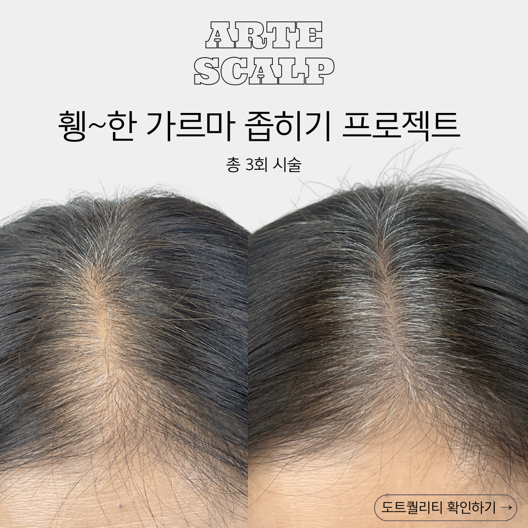 아르떼스칼프