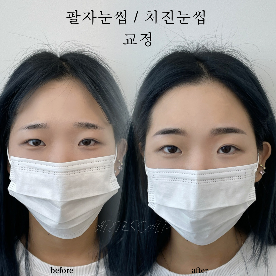 아르떼스칼프