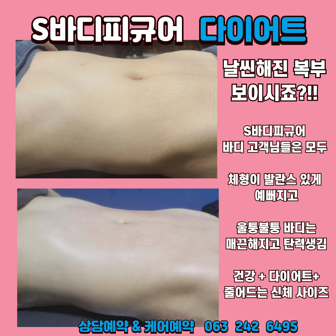 S바디피규어 피부 체형관리 photo 2