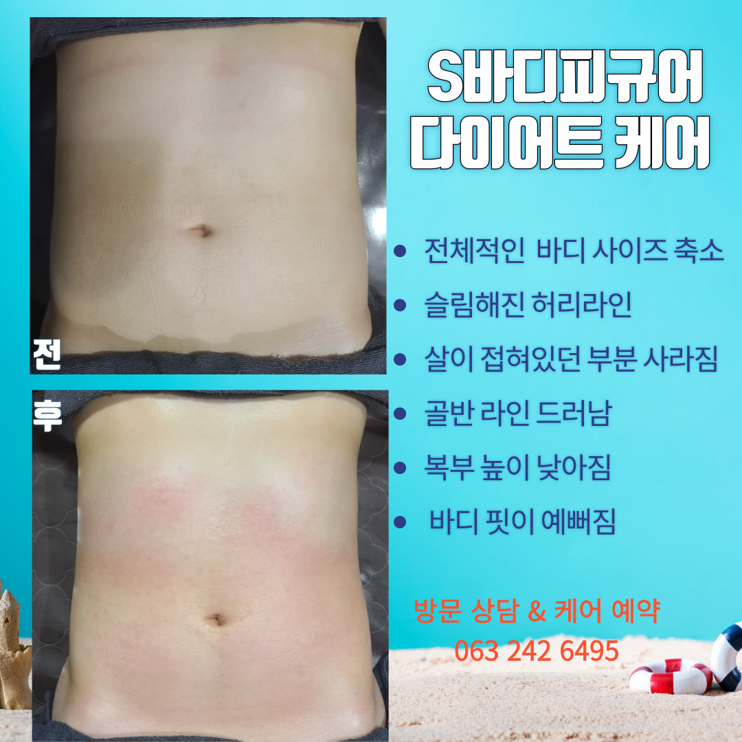 S바디피규어 피부 체형관리 photo 3