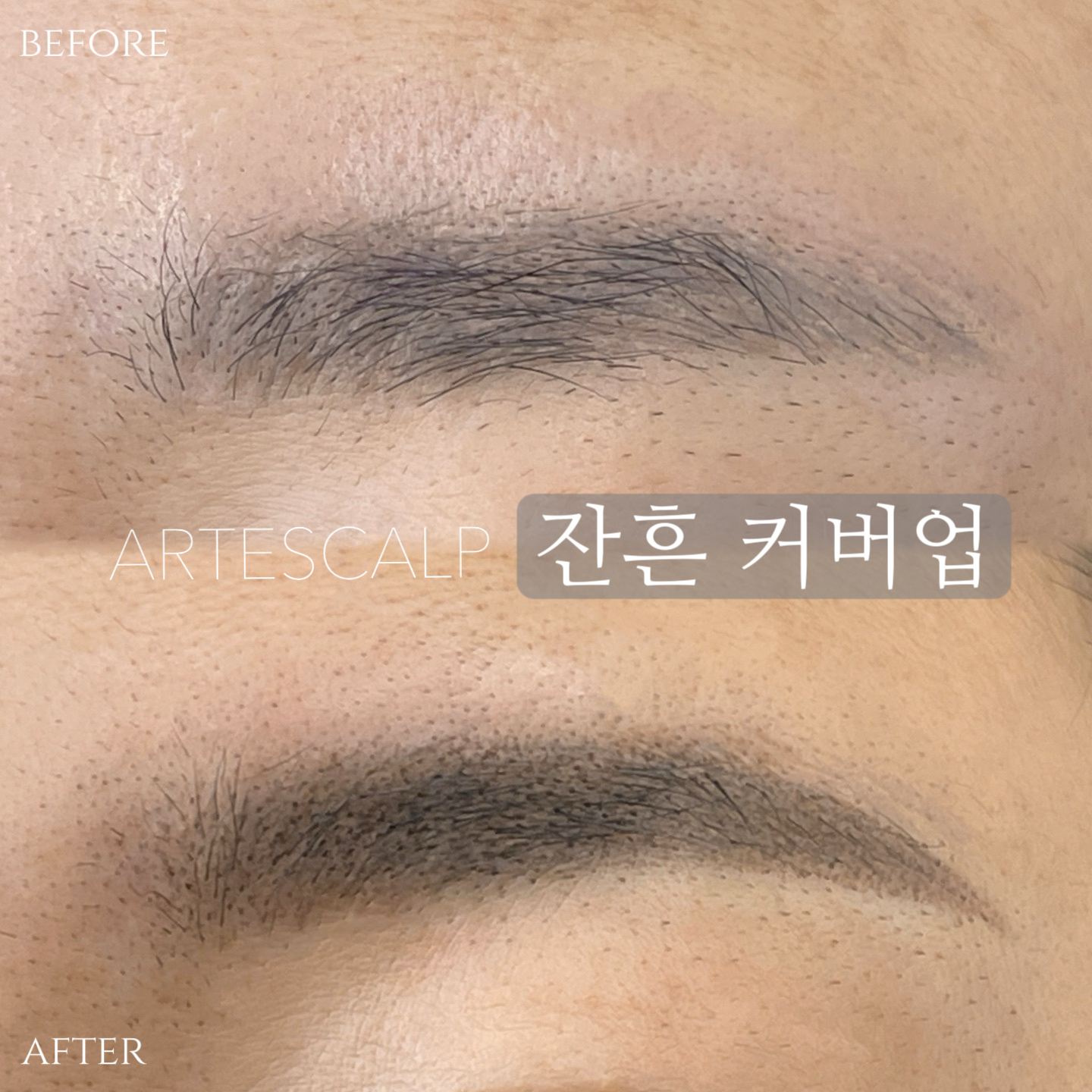 아르떼스칼프