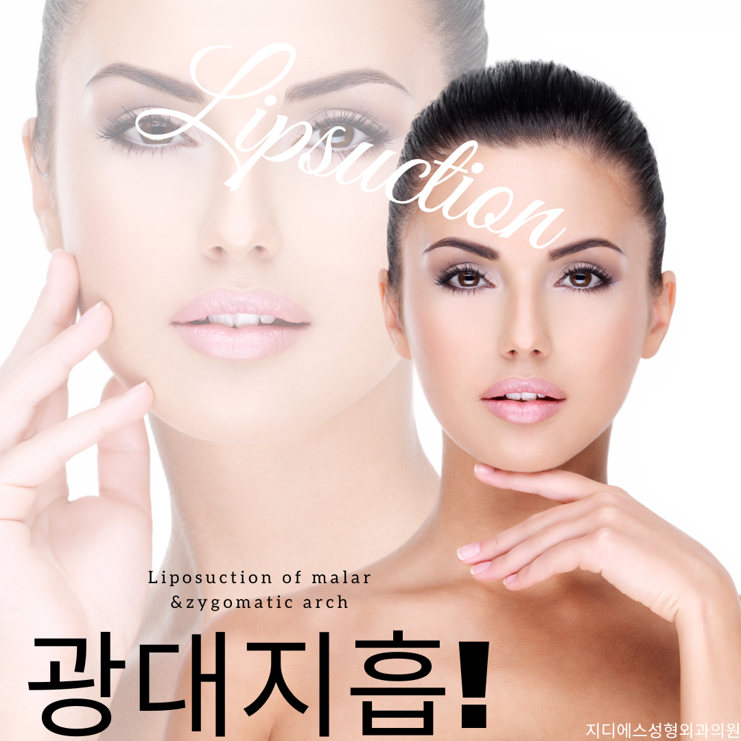 지디에스성형외과의원 대표 이미지