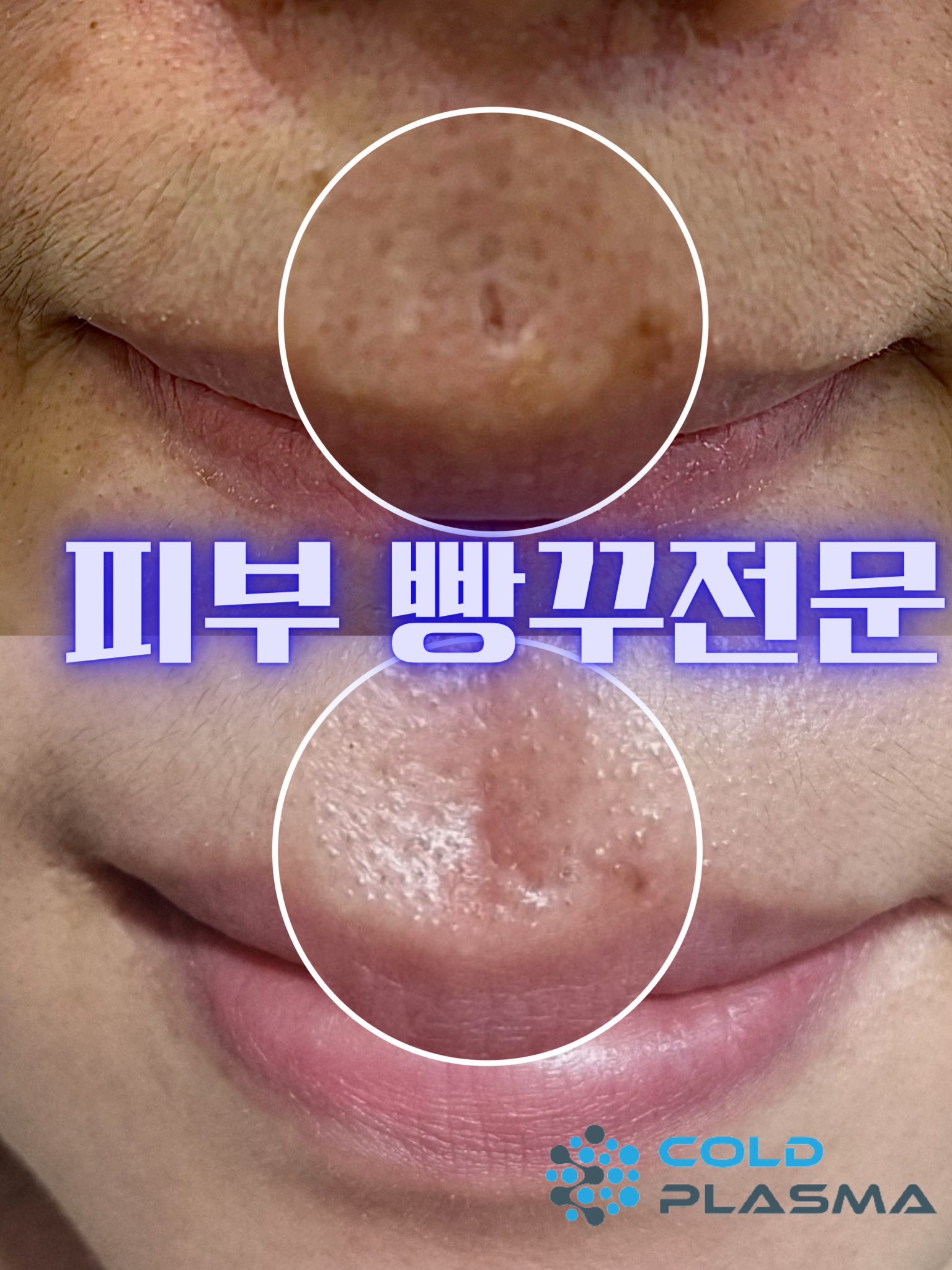 플라즈마헤베 울산본점
