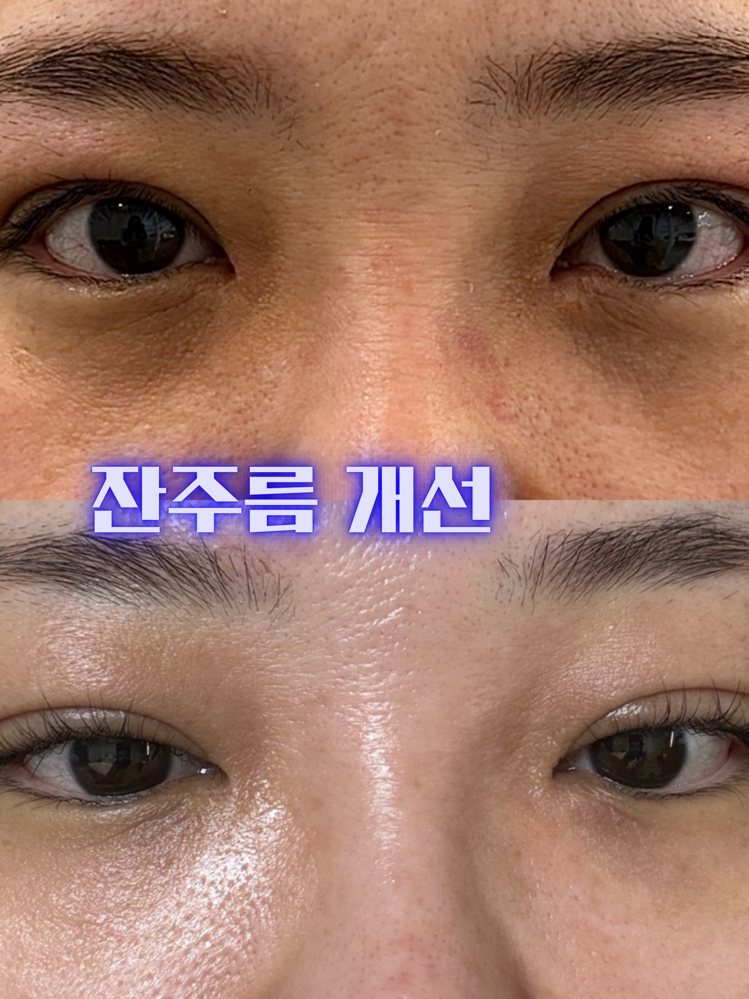 플라즈마헤베 울산본점