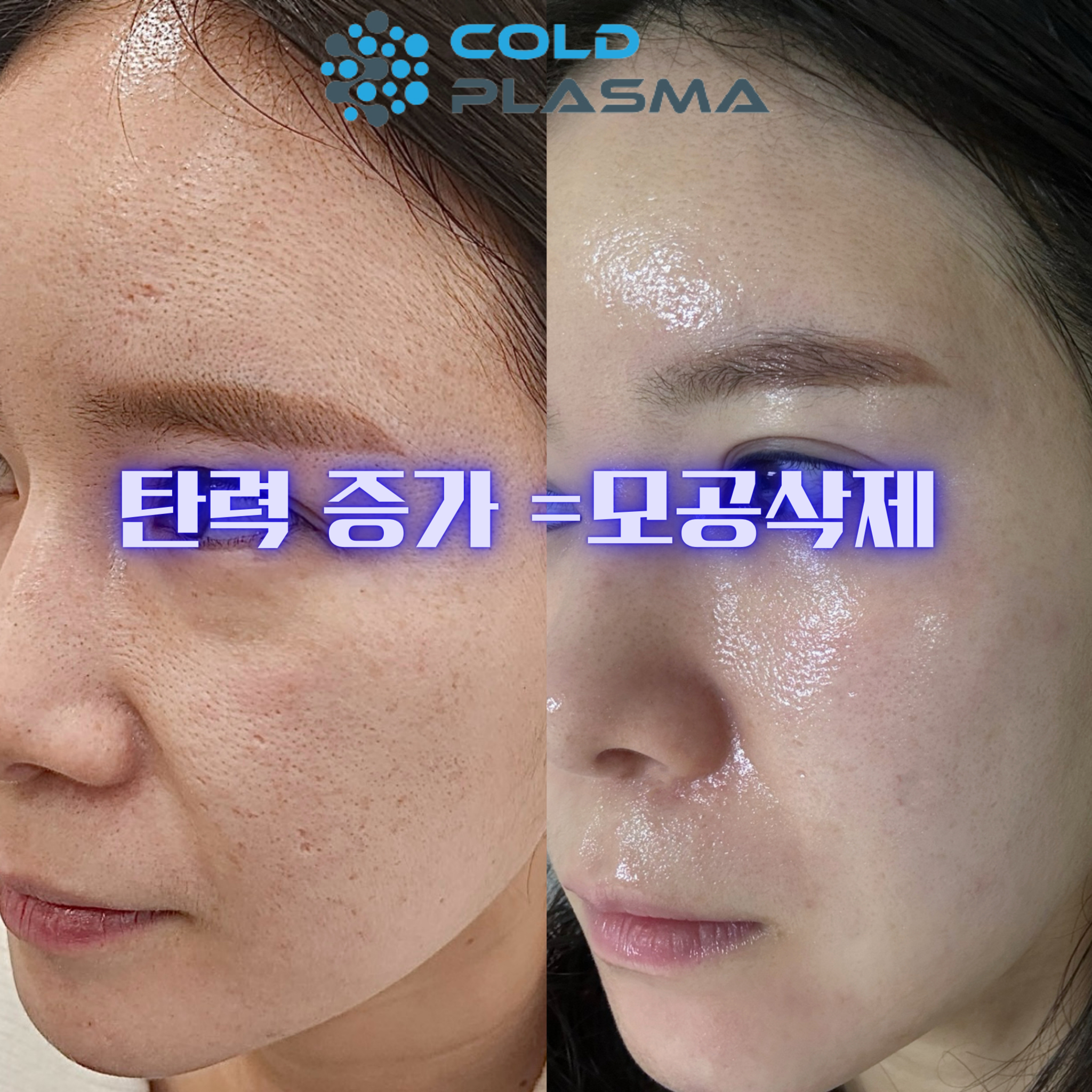 플라즈마헤베 울산본점