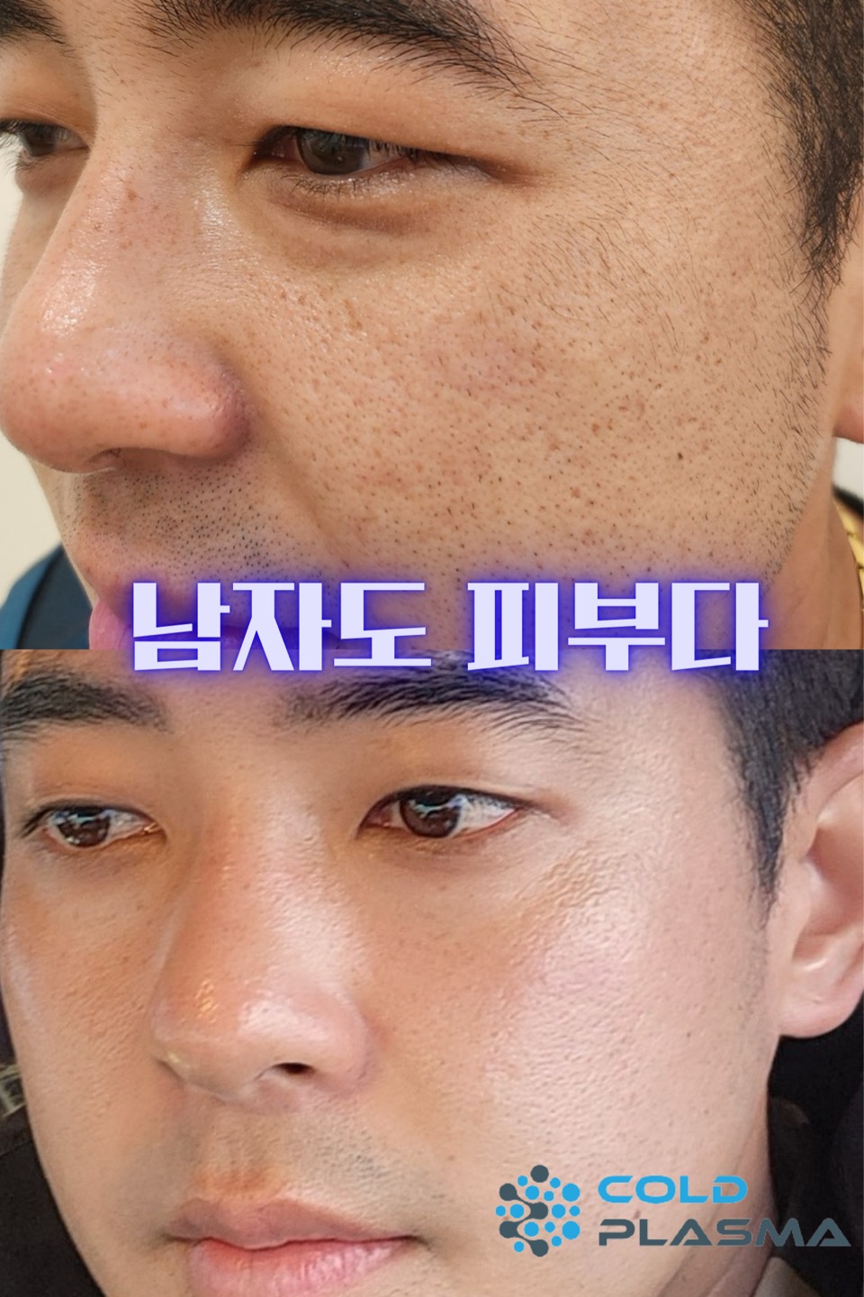 플라즈마헤베 울산본점
