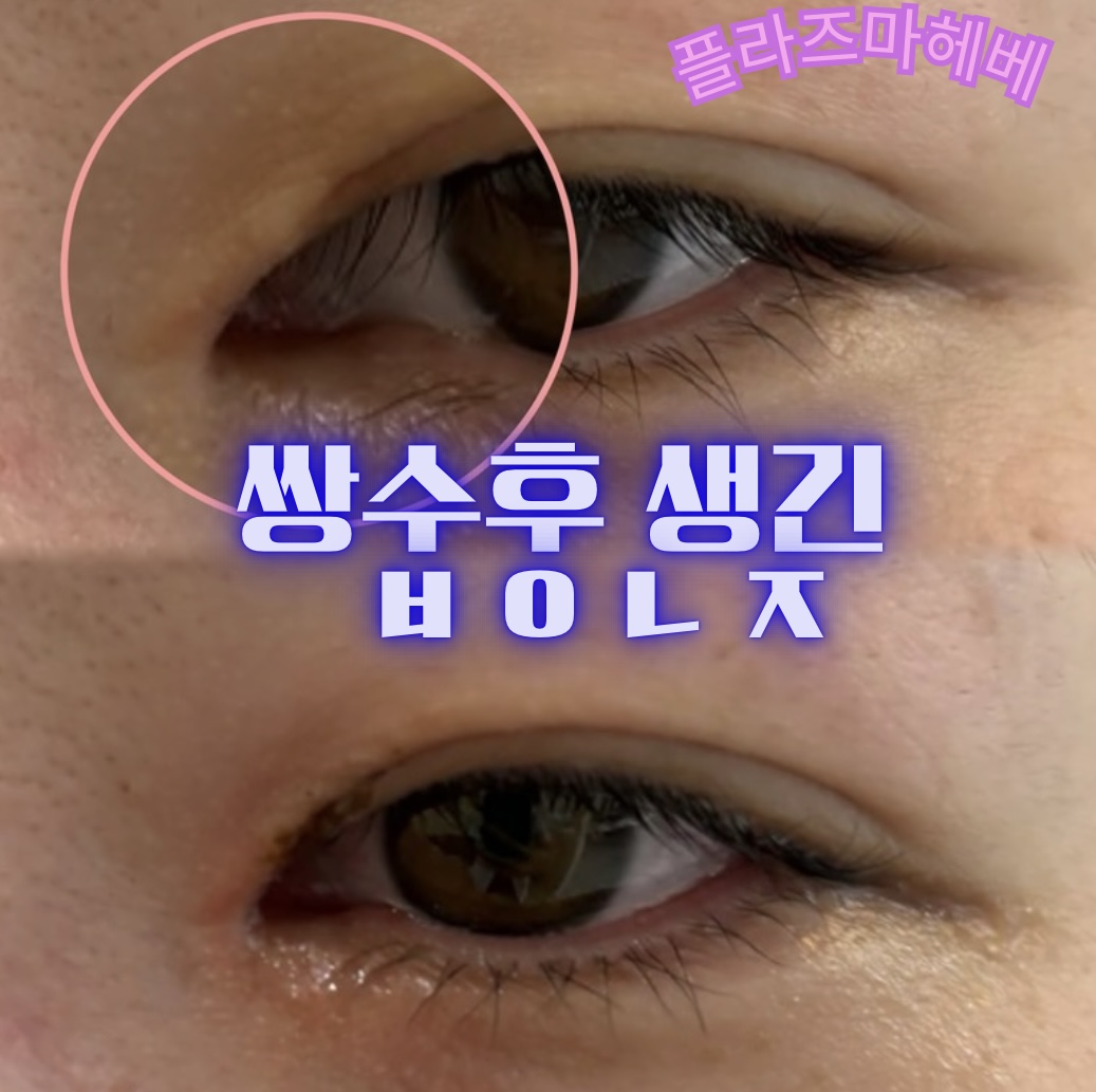 플라즈마헤베 울산본점