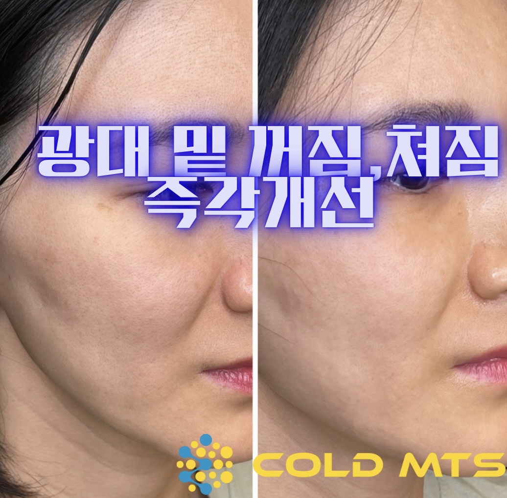 플라즈마헤베 울산본점