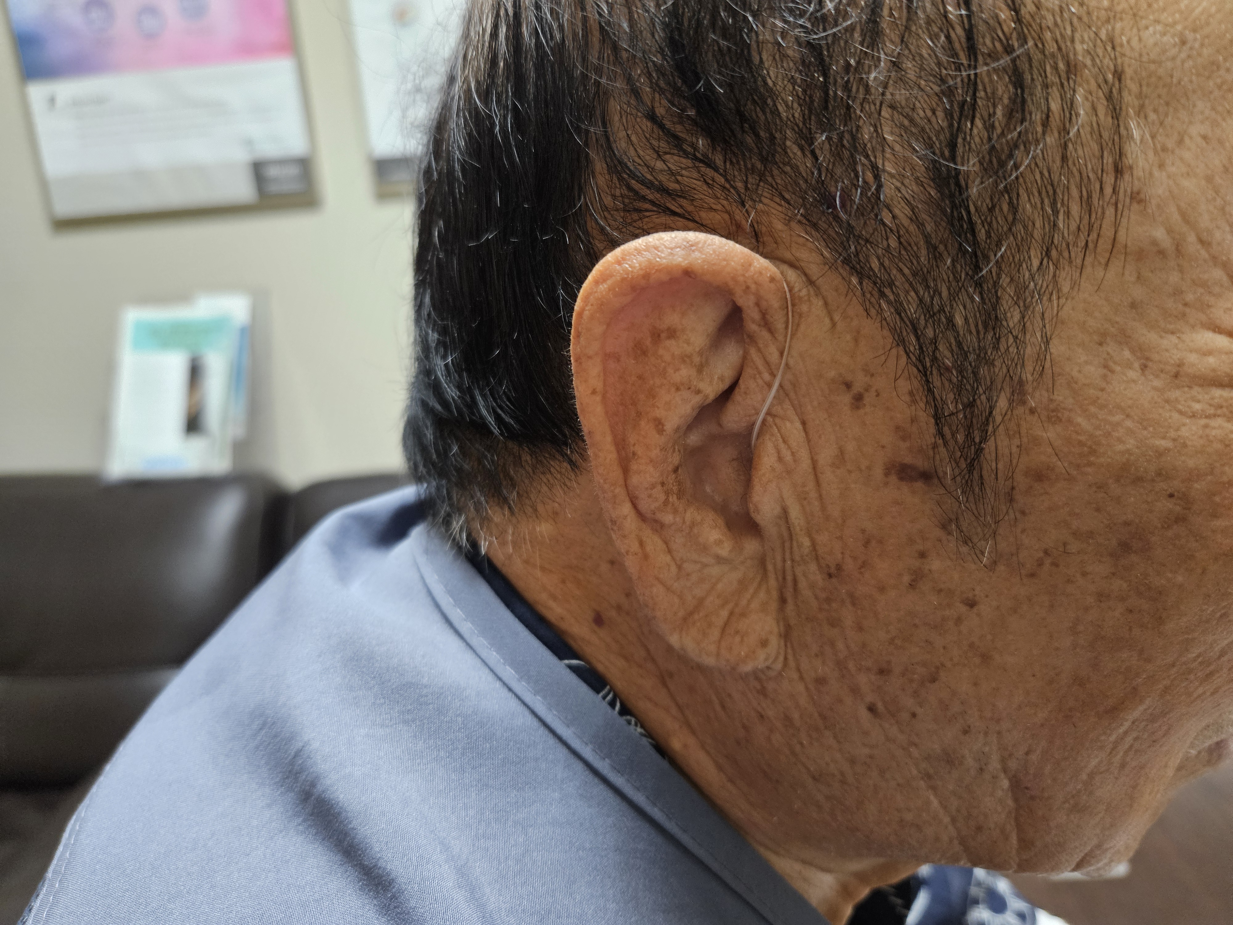 코아보청기 대표 이미지