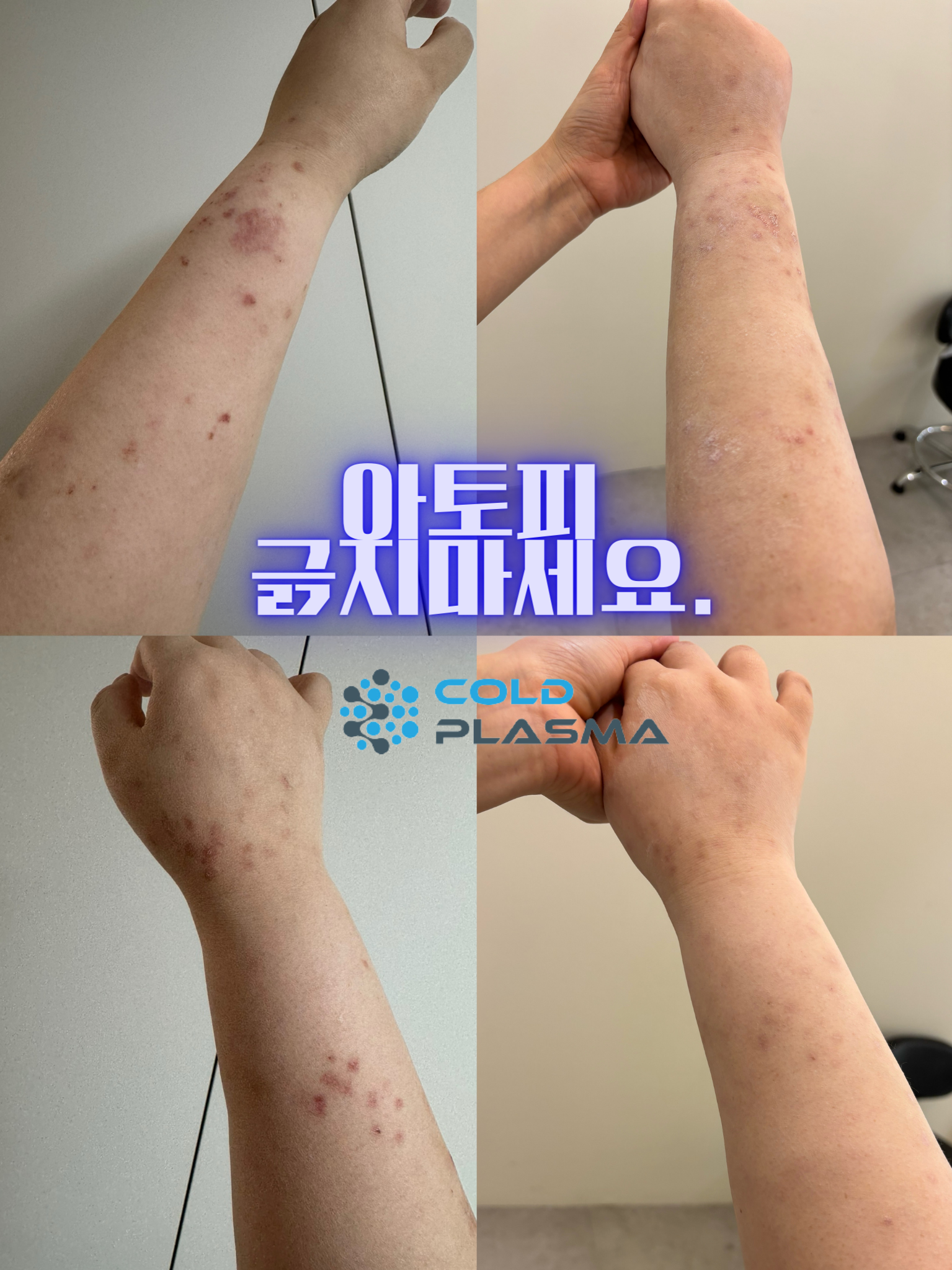 플라즈마헤베 울산본점