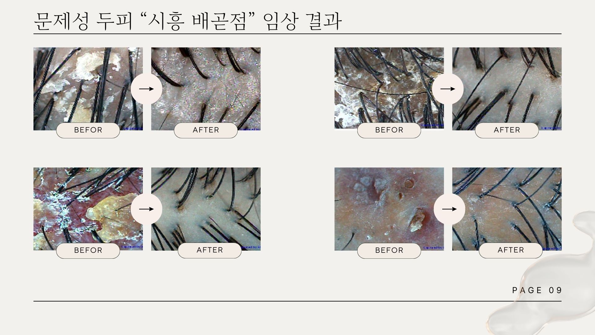 웰킨두피탈모센터 시흥배곧점
