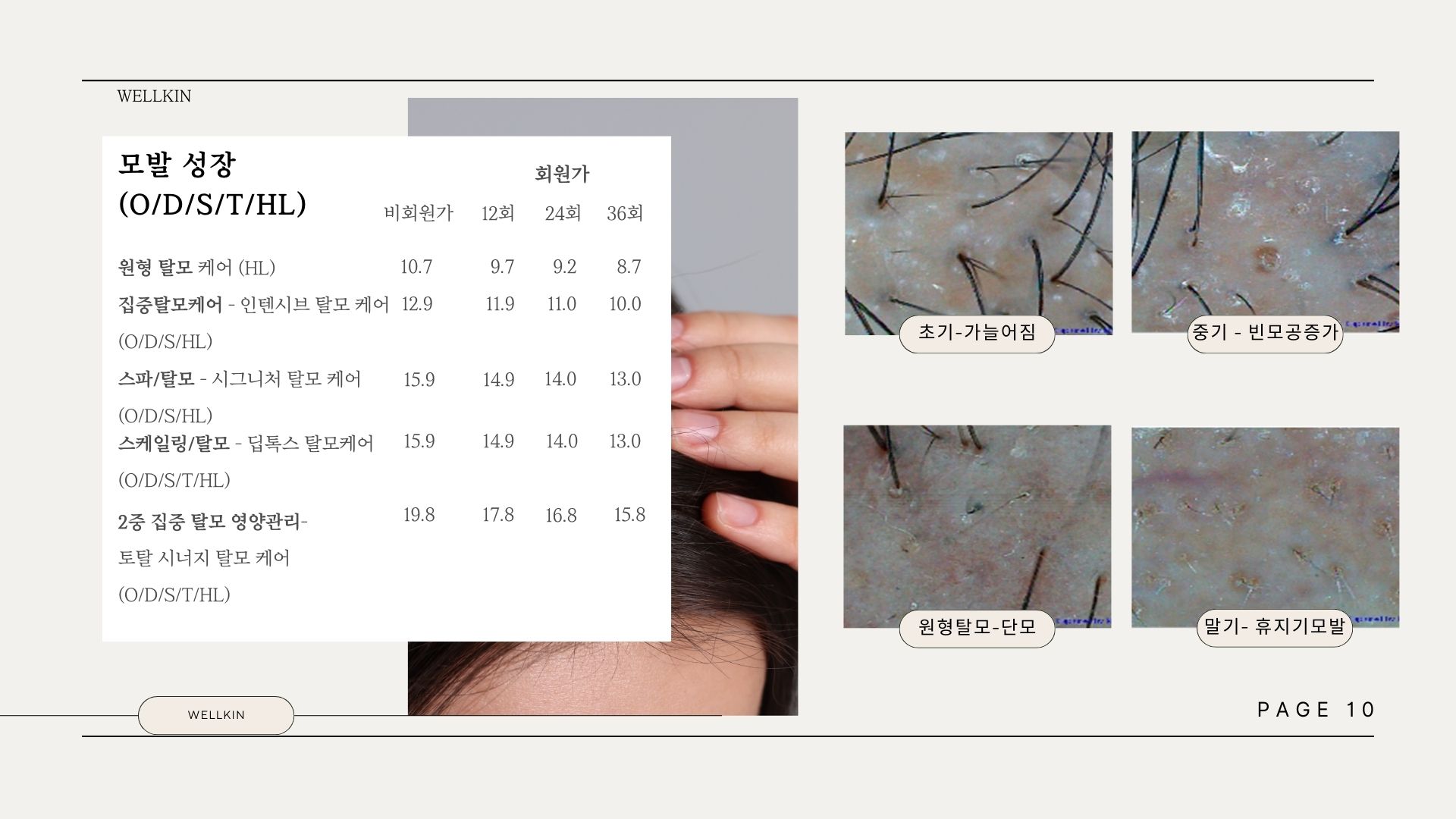 웰킨두피탈모센터 시흥배곧점