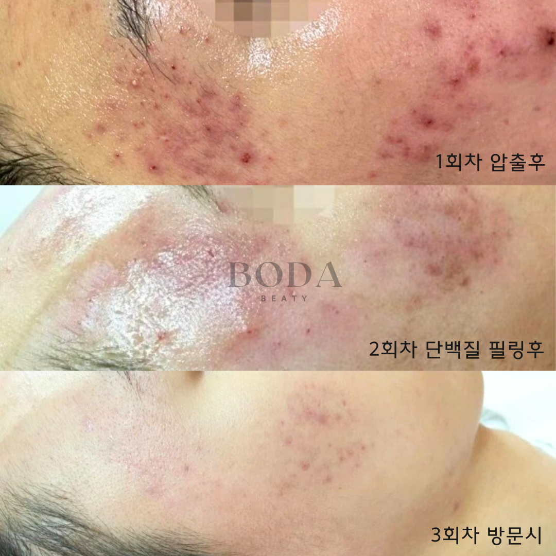 보다뷰티 성남 본점 대표 이미지