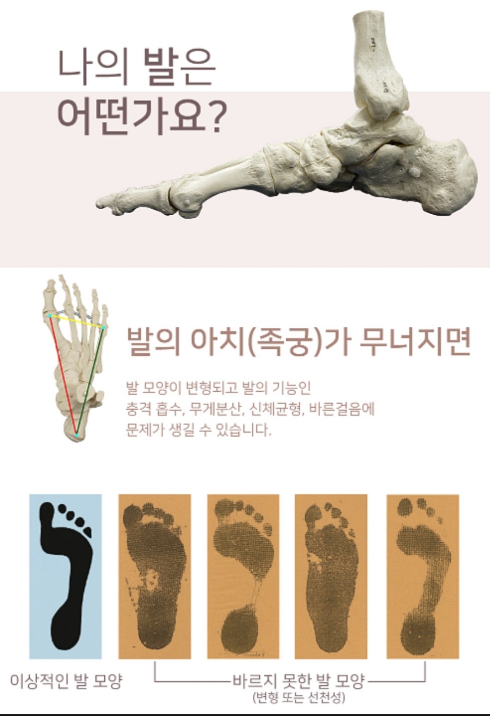알즈너 천안건행대리점