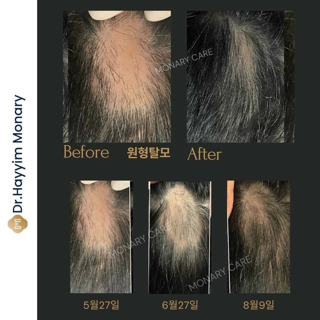 더블라인스칼프 제주점 photo 4